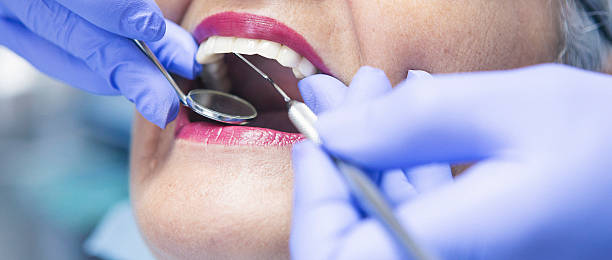 Best Emergency Wisdom Tooth Extraction in Hunter, TN